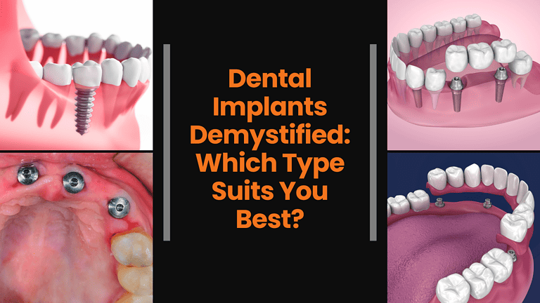 dental-implants-near-me